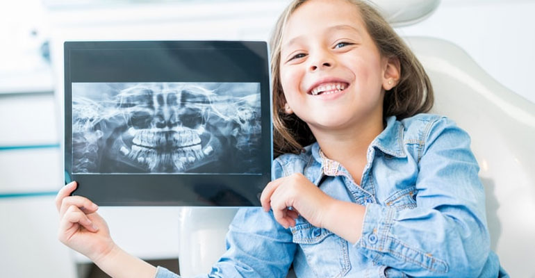 are-dental-x-rays-safe
