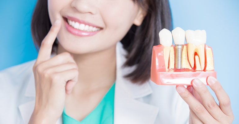 bone loss dental implants solutions toronto
