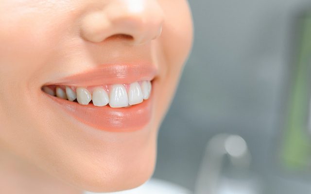 Dental Crowns Vs Veneers Which Is Right For You