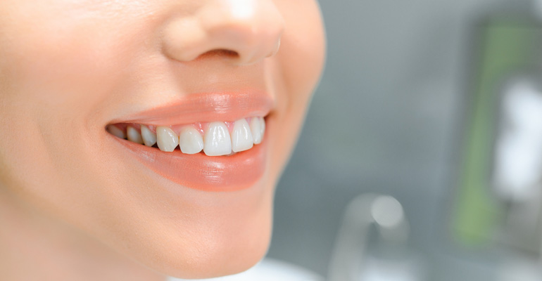 Dental Crowns Vs Veneers Which Is Right For You