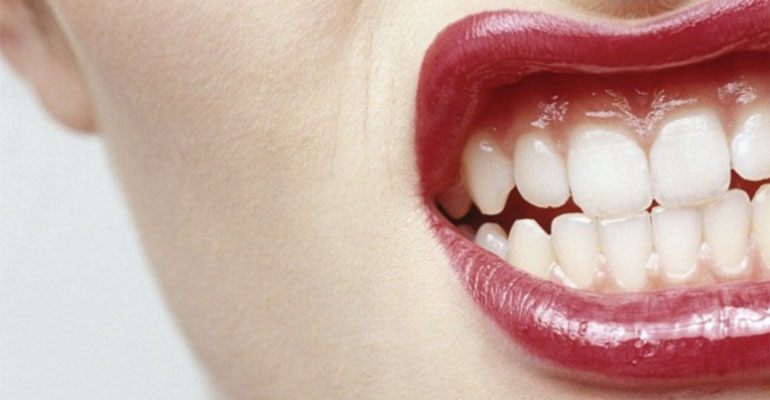 grinding-teeth-bad-health-bruxismjpg